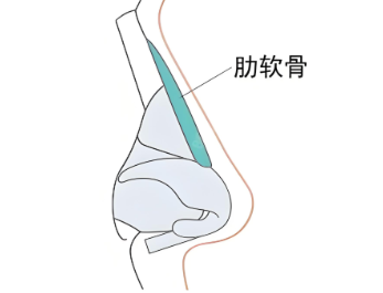 肋软骨隆鼻