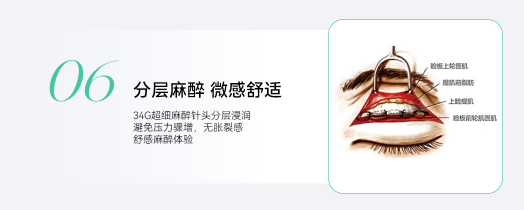 金标美眼优势6